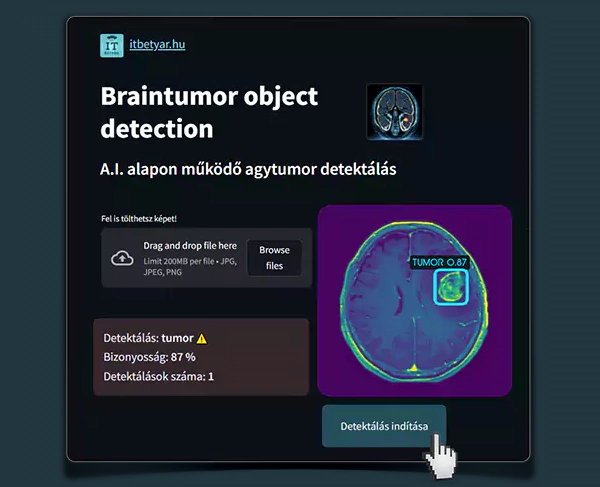 Brain tumor – Object recognition
